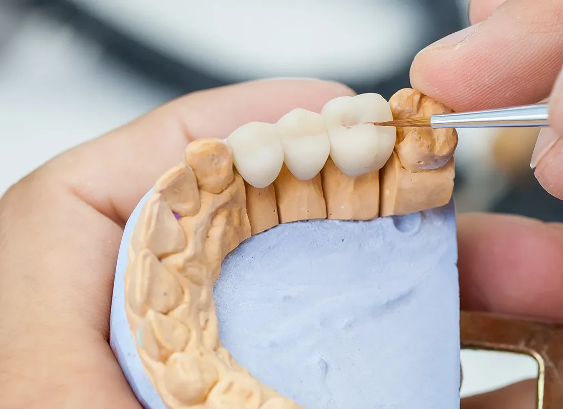 Dental Bridges in Redlands, CA