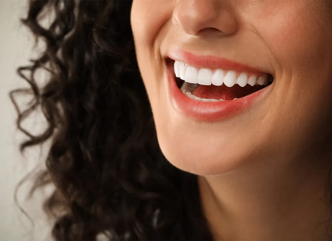 Signs you may need gum contouring — Dentist of Redlands