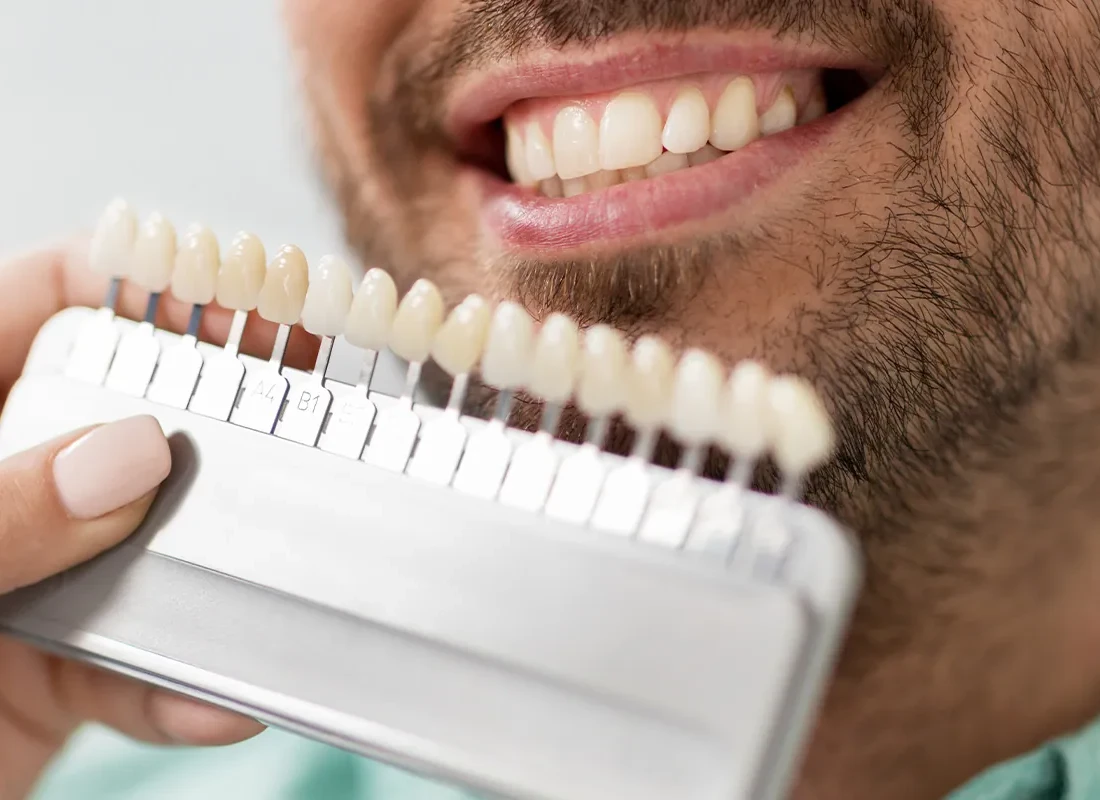 Professional Teeth Whitening in Redlands, CA