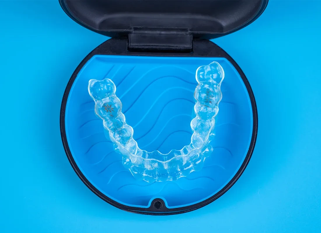 Signs you may need invisalign clear aligners — Dentist of Redlands