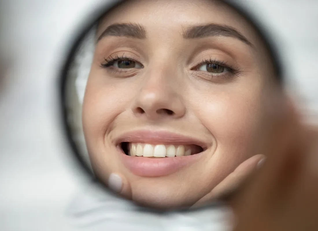 Dental Bonding at Dentist of Redlands