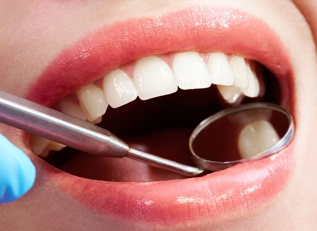 Dental Exams at Dentist of Redlands