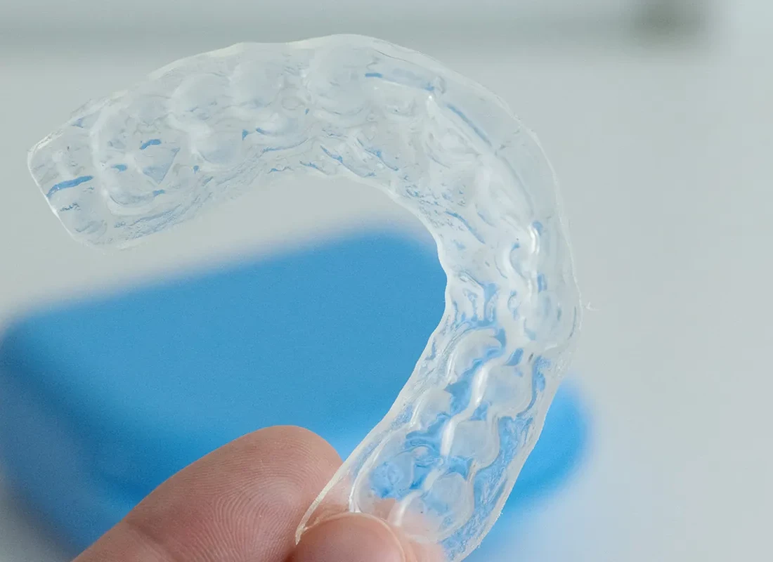 Signs you may need mouth guards — Dentist of Redlands