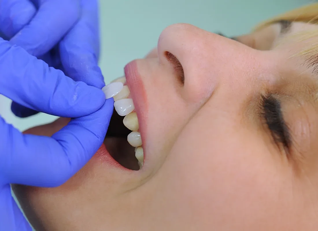 Cosmetic Dentistry at Dentist of Redlands